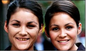 イギリスBBC放送双子の写真（喫煙者と非喫煙者）